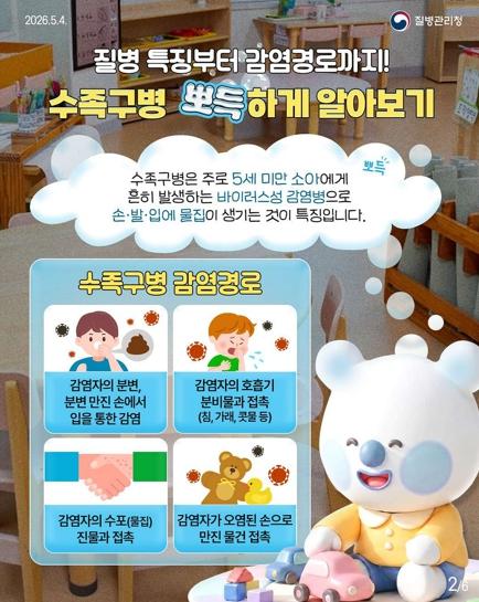 대구시, 손·발·입안 수포성 발진 일으키는 수족구병 주의하세요 기사 이미지